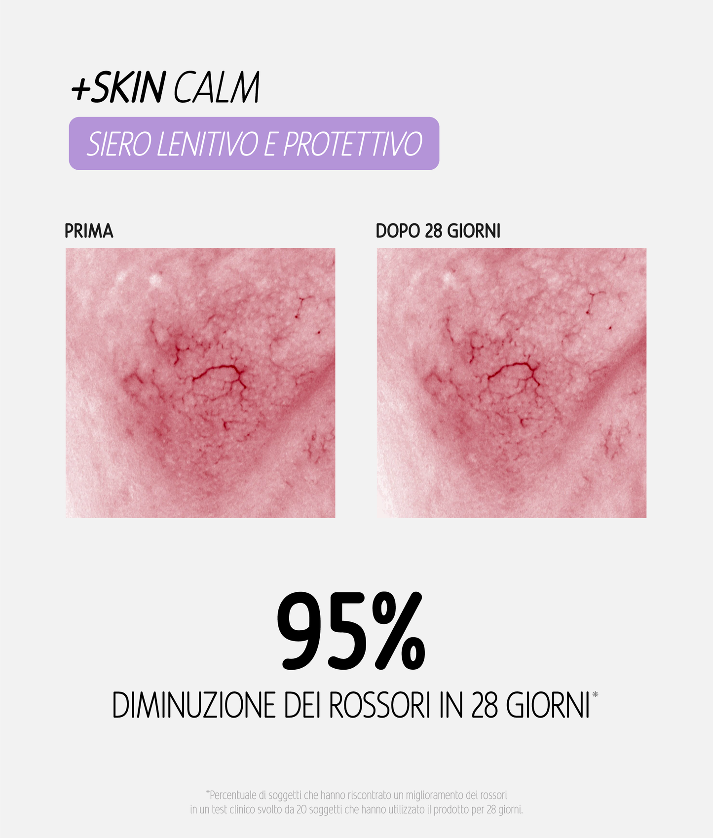 Siero viso +SKIN Calm