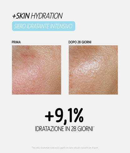 Siero viso +SKIN Hydration